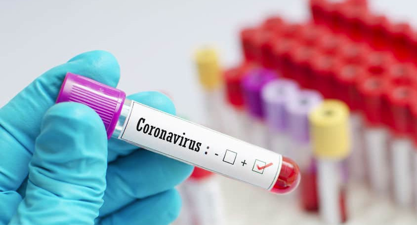 Covid-19, Point du Jour: 106 nouveaux cas dont 13 communautaires, 110 guéris, 17 cas graves, 1682 personnes sous traitement