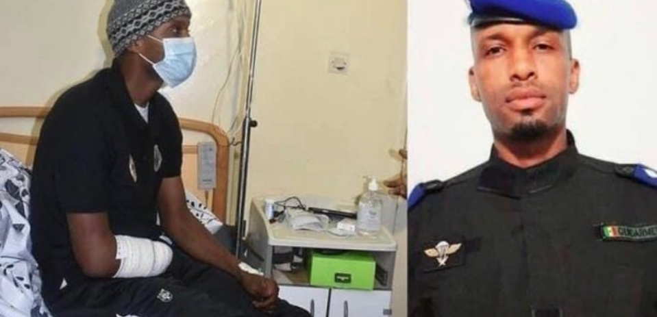 Amputé lors des émeutes de mars : L'agent du GIGN Tony Kâ donne de ses nouvelles Amputé lors des émeutes de mars : L'agent du GIGN Tony Kâ donne de ses nouvelles