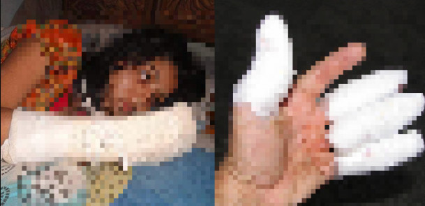 MBOUR : SON MARI AYANT PRIS UNE SECONDE ÉPOUSE, ELLE LUI FRACASSE DEUX DOIGTS ET MENACE DE LUI COUPER LES PARTIES INTIMES.