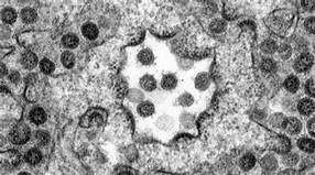 Un cas suspect de coronavirus détecté à l'aeroport de Conakry