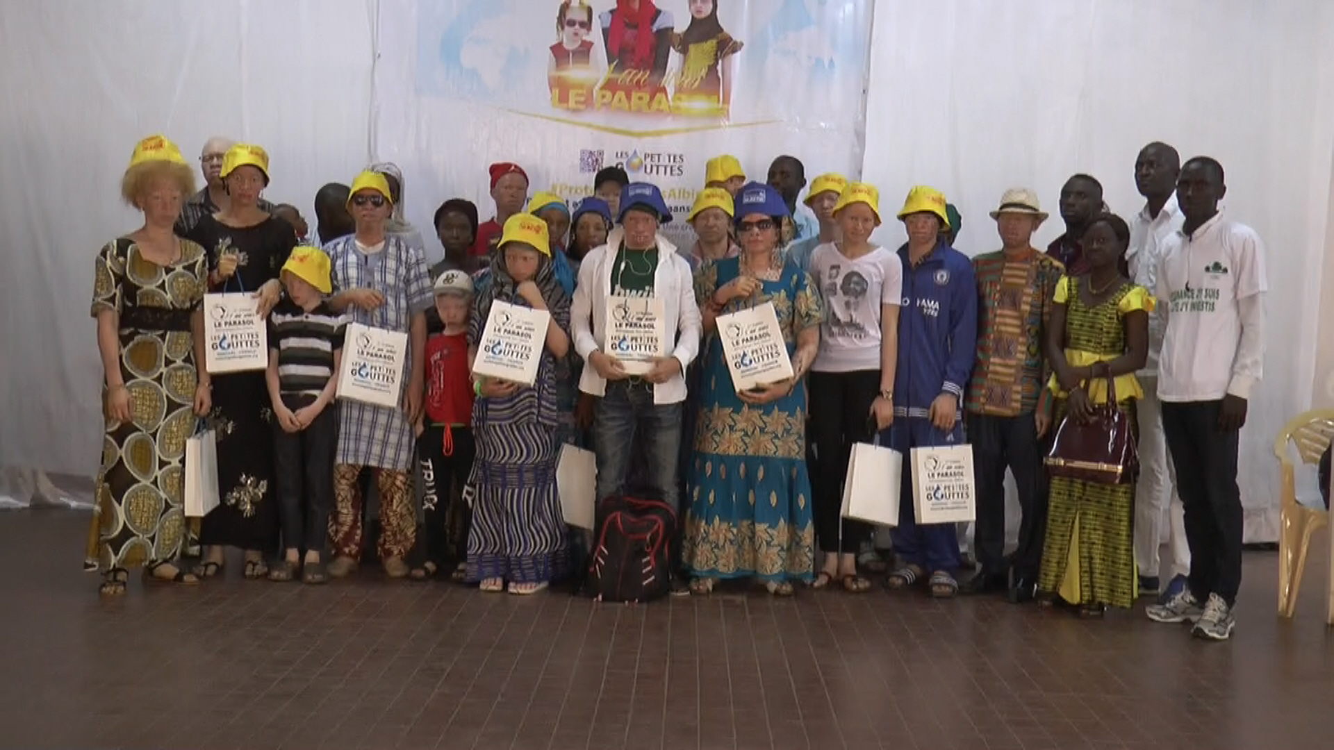 Ziguinchor/covid-19: se sentant oubliés,les albinos en colere