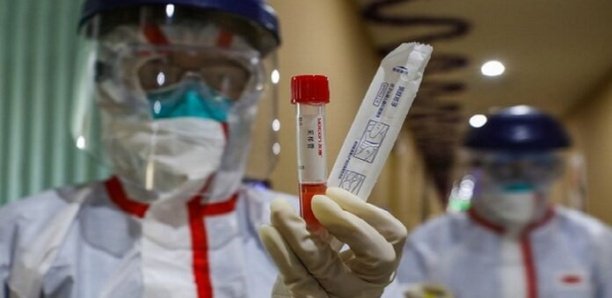 Erreurs tests Covid-19: Pr Coumba Touré Kane de l’Iressef parle de «test de diagnostic nouveau qui n’est pas fiable à 100%»