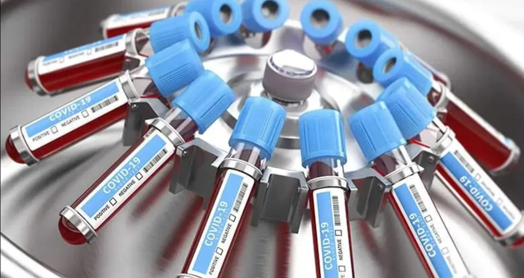 ​Tests payants : PrAmadou Dieyye directeur des laboratoires « ce n'est pas une décision de l’Etat »