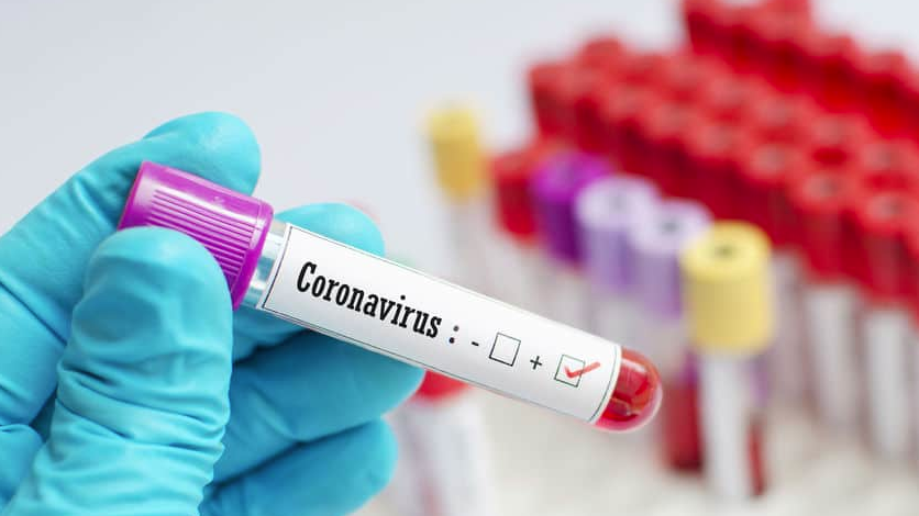 Point du Jour: 145 nouveaux cas dont 26 communautaires, 62 guéris, 47 cas graves, 2917 personnes sous traitement