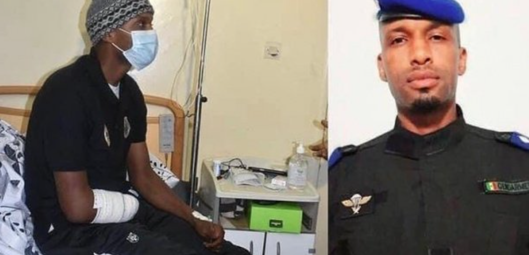 Amputé lors des émeutes de mars : L'agent du GIGN Tony Kâ donne de ses nouvelles