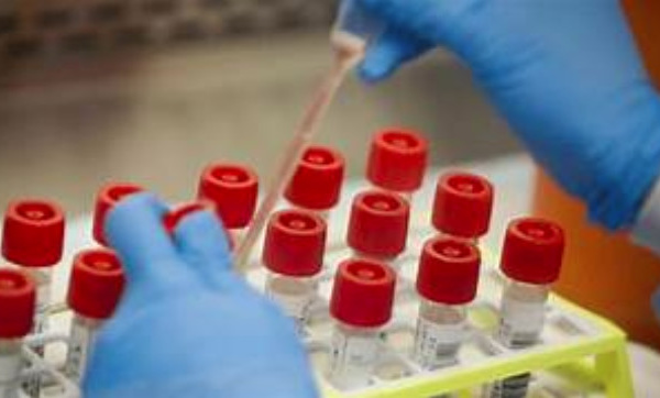 COVID-19: La situation se complique à la maison d’arrêt et de correction de Ziguinchor.